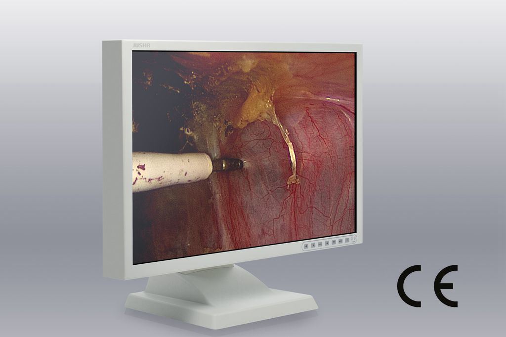 22 Inch 1680X1050 LCD Display for Digital Endoscope, CE