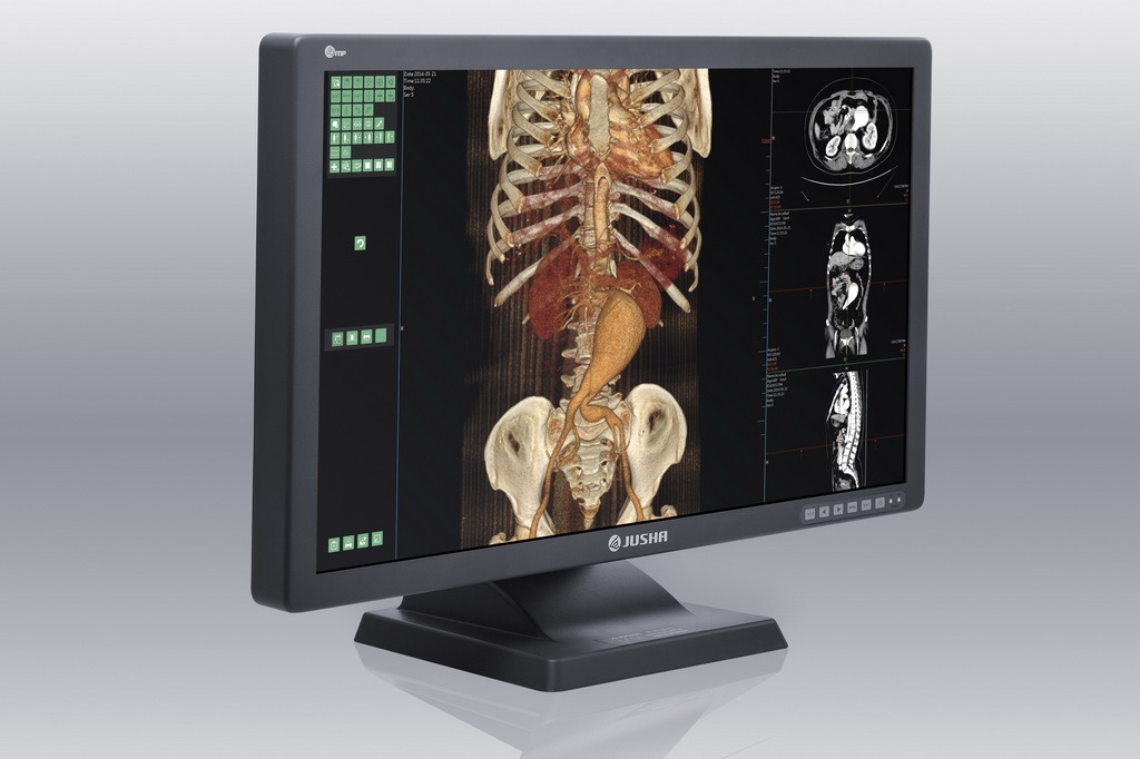 (JUSHA-C43) 4MP Color Medical Display for X Ray Imaging, LCD Display, Dental Equipment, LCD Monitor