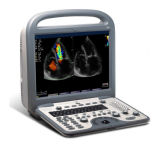 Ultrasound for Musculoesqueletal&Endovaginal Diagnosis, Touch Screen Mobile Color Ultrasound