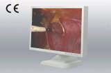 22 Inch 1680X1050 LCD Display for Digital Otoscope, CE