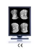 2MP 1600X1200 LCD Display for Digital Dental Panoramic X-ray, CE