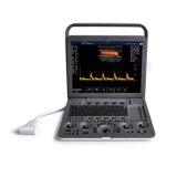 FDA Approved Touch Screen Mobile Color Ultrasound with Best Performance