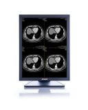 (JUSHA-M21) 2m Monochrome Radiology Display