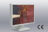 22 Inch 1680X1050 LCD Display for Digital Endoscope, CE