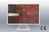 (JUSHA-ES22) 22-Inch Surgical Color LCD Display for Medical Equipment, Endoscope