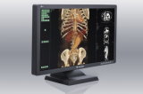 (JUSHA-C43) 4MP Color Medical Display for X Ray Imaging, LCD Display, Dental Equipment, LCD Monitor