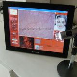 CE Certicated Touch Screen Mobile Skin Analyzer