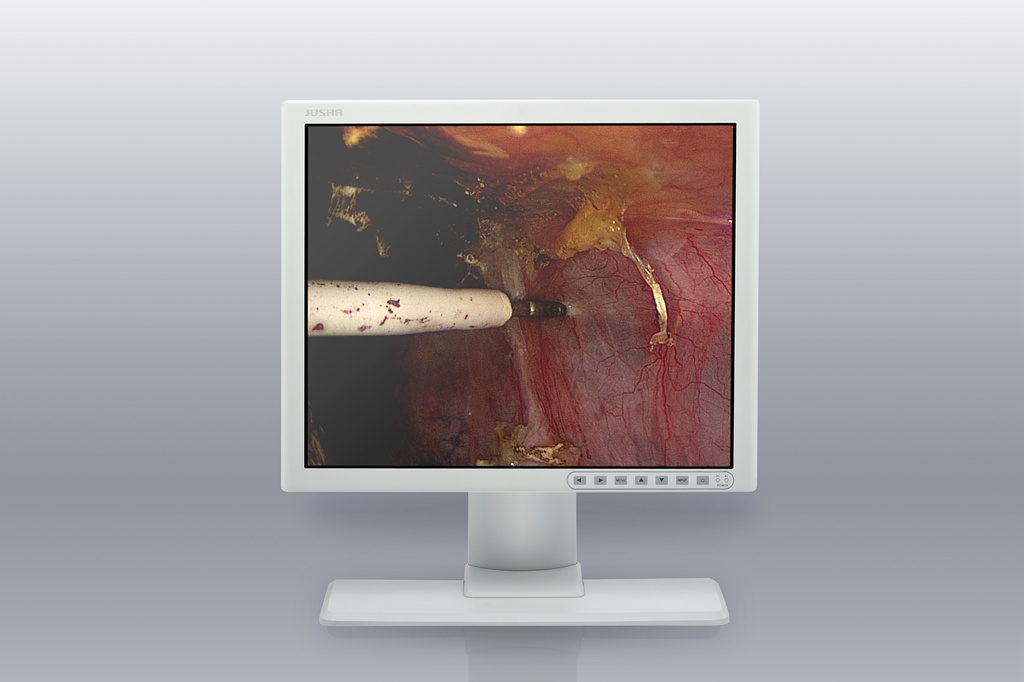 (JUSHA-ES19B) 19-Inch Surgical Color LCD Display