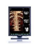 (JUSHA-C23D) 2m LED Color Display, Medical Monitor, LCD Display