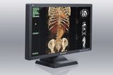 (JUSHA-C43) 4MP Color Medical Display for X Ray Imaging, LCD Display, Dental Equipment, LCD Monitor